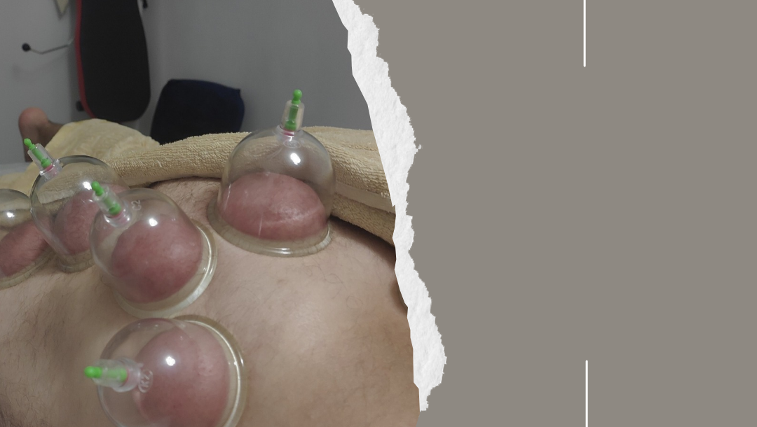 Фізіотерапія