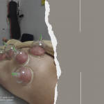 Фізіотерапія